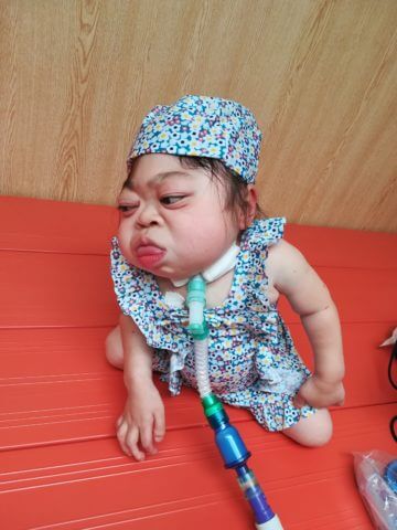 【医療的ケア児の学校生活】呼吸器っ子のプールデビュー